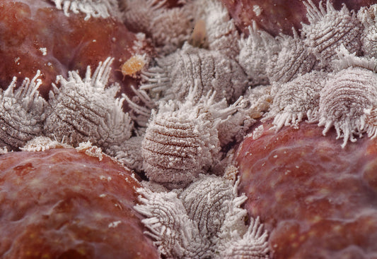 Difference Between Worms, Protozoa, and Flukes